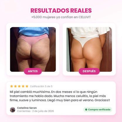 CELUVIT® — Reducí la celulitis y transformá tu piel