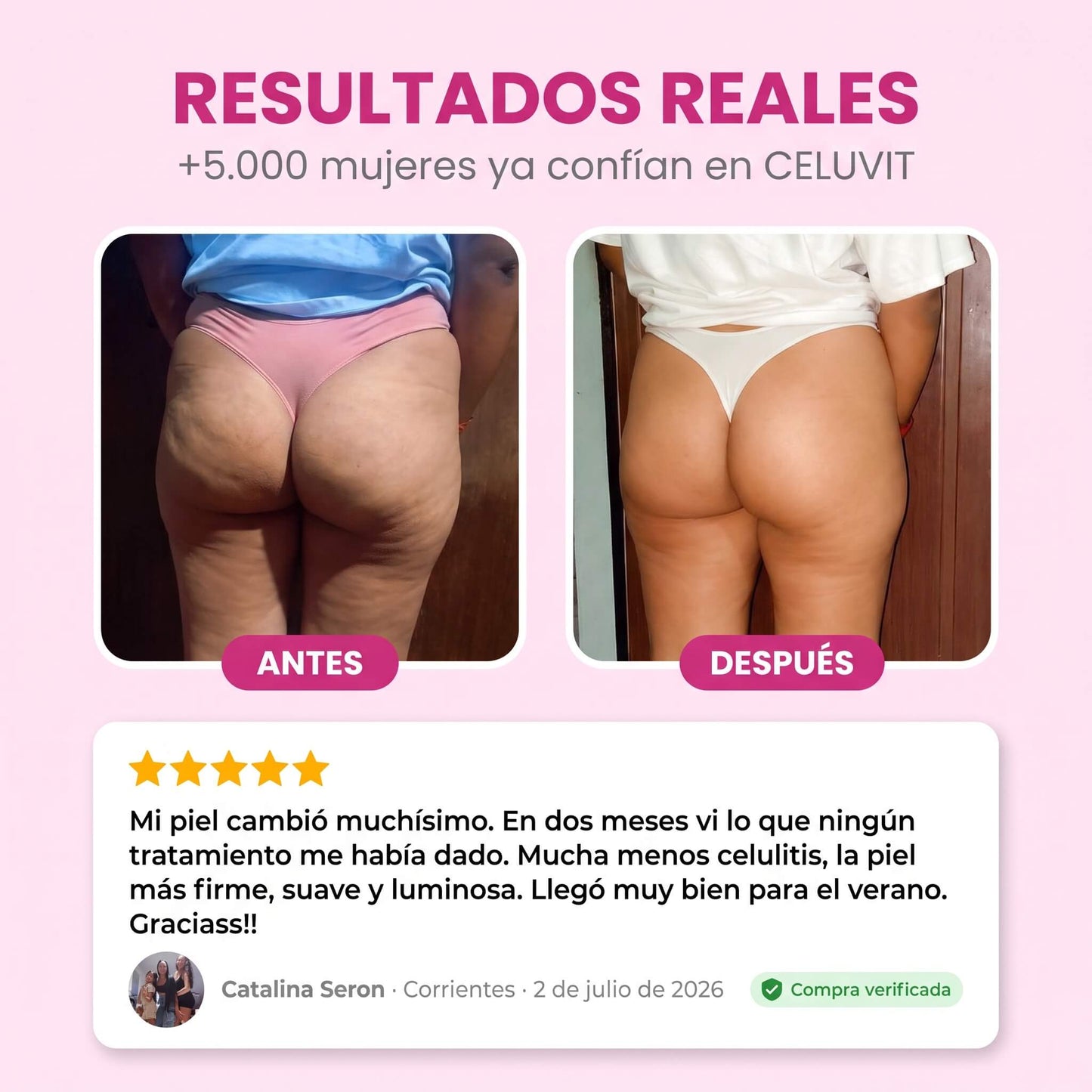 CELUVIT® — Reducí la celulitis y transformá tu piel