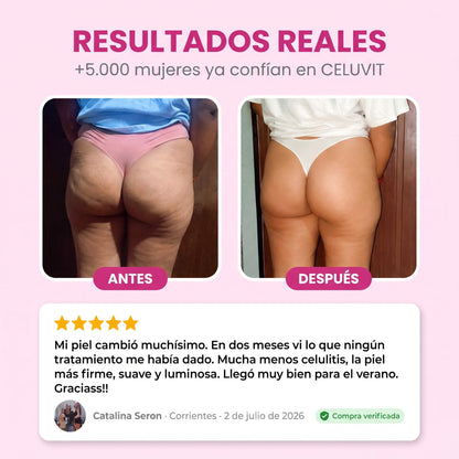 CELUVIT® — Reducí la celulitis y transformá tu piel